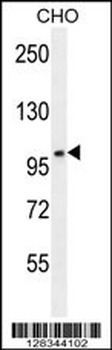 CCDC39 Antibody