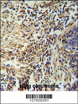 ZNF720 Antibody