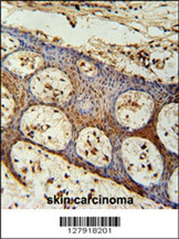 ZC3H3 Antibody