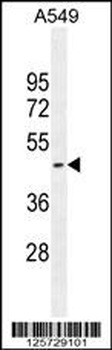 HEMK1 Antibody