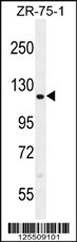 CCDC33 Antibody