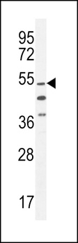 VWA9 Antibody