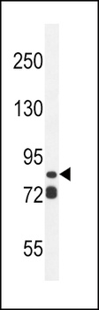 ASAP3 Antibody