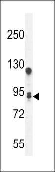 TMEM168 Antibody