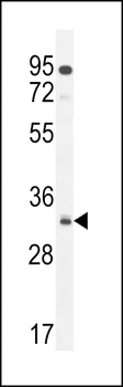 NUSAP1 Antibody