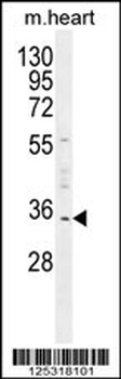 UPP2 Antibody