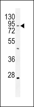 TBC14 Antibody