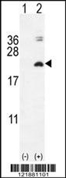 IL17F Antibody