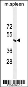 ERCC8 Antibody