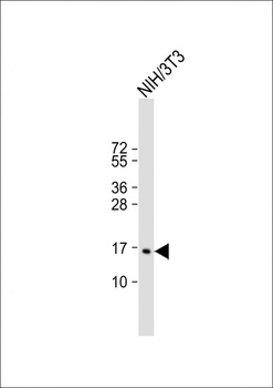 CDKN2C Antibody