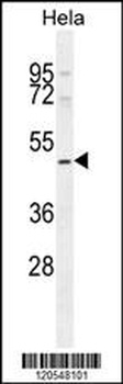 SMYD1 Antibody