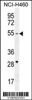 CD2BP2 Antibody