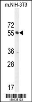 CTDSPL2 Antibody