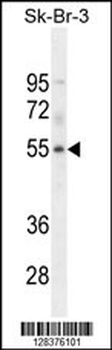 DCAF4L1 Antibody