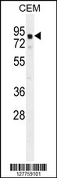 GLB1L2 Antibody