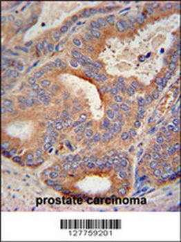 GLB1L2 Antibody