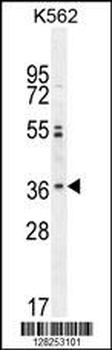 OR2M3 Antibody