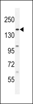 BCORL1 Antibody
