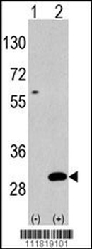 UBTD1 Antibody