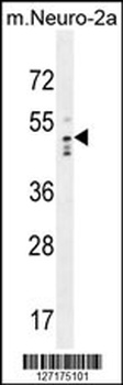 WDSOF1 Antibody