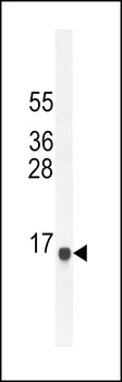 SPAG11A Antibody