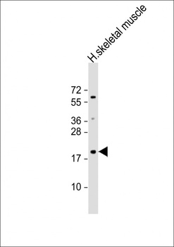 IMMP1L Antibody