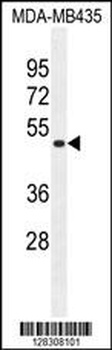 TAPT1 Antibody