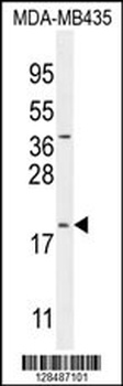 C20orf173 Antibody