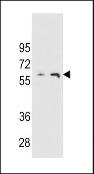 THUMPD3 Antibody