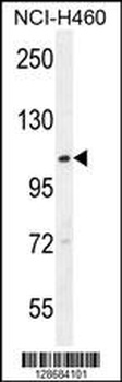 ACAD10 Antibody