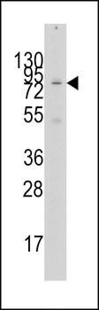GCN5 Antibody