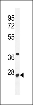 RRP36 Antibody