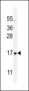 C21orf2 Antibody