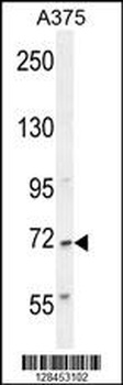 ALS2CR11 Antibody