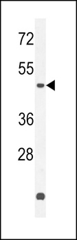 ZNF572 Antibody