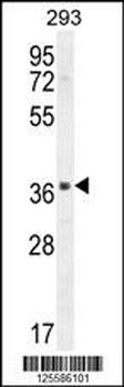 SPACA1 Antibody