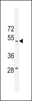 RTN4IP1 Antibody