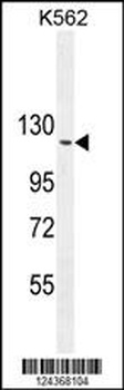 ARHGAP17 Antibody