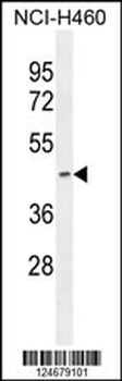 PDHA2 Antibody