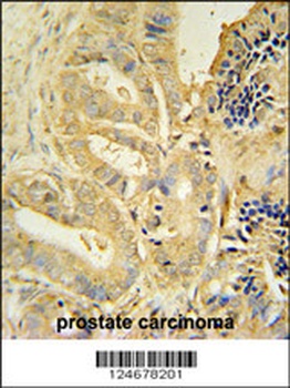 TLL1 Antibody