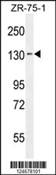 TLL1 Antibody