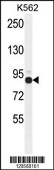 ZNF366 Antibody