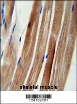 KIAA1310 Antibody