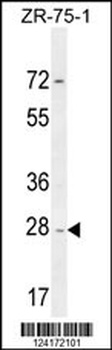 NDUFAF1 Antibody