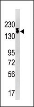 SETDB1 Antibody