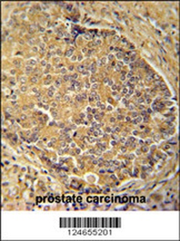 IGSF1 Antibody
