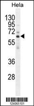 HYAL2 Antibody