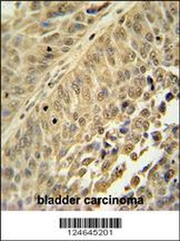 HNRNPC Antibody