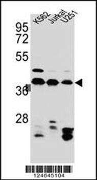 HNRNPC Antibody