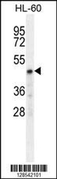CHST2 Antibody